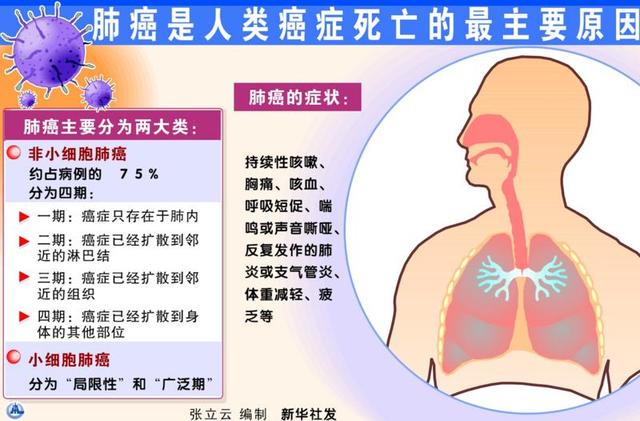 筛查胜似神药！微创手术可治愈早期肺癌