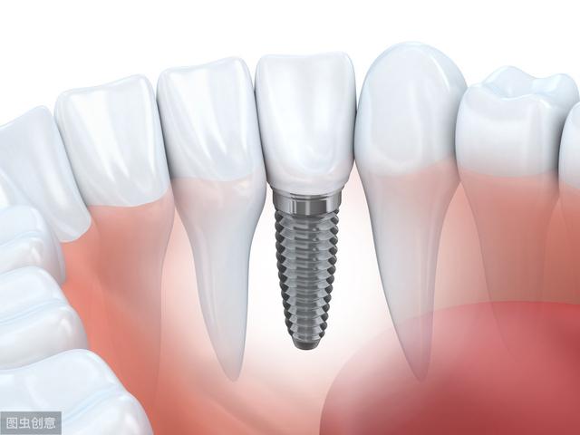 种植牙怎么种进牙龈？直接打钢钉不疼吗？专业医生告诉你利与弊