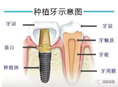 刚刚公布！再过几天，牙齿矫正、解决缺牙，省一大笔钱！