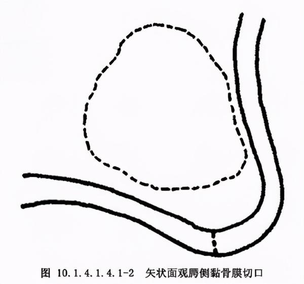 庄龙飞：什么是上颌窦提升术？上颌窦提升术的流程步骤是怎样的？