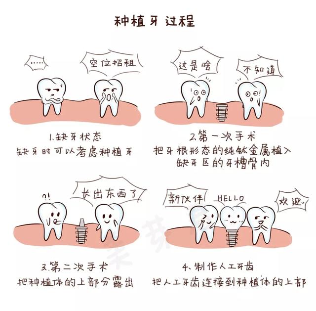 种植牙怎么种进牙龈？直接打钢钉不疼吗？专业医生告诉你利与弊