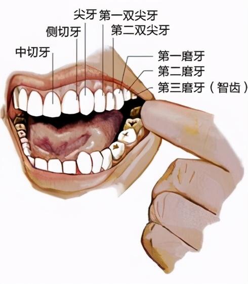 关于拔智齿必须了解这几件事