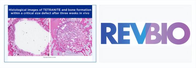 美国公司RevBio开发了一种用于种植牙科的骨粘合生物材料