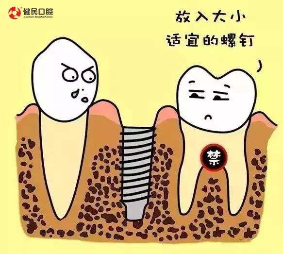 幽默的漫画形式来告诉大家什么是“种植牙”？牙齿的呼唤太形象了