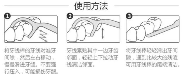 想与这颗“牙”共度余生，那这些问题你要注意