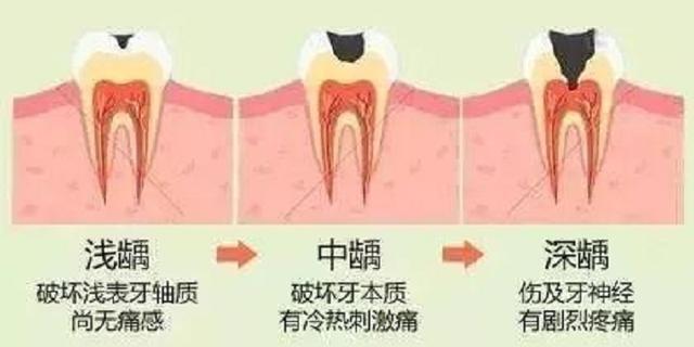 种植一颗牙要花费两到三万元，是市场乱象还是事实如此？