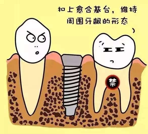 幽默的漫画形式来告诉大家什么是“种植牙”？牙齿的呼唤太形象了