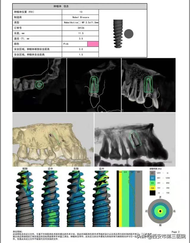 【关注口腔健康】数字化种植牙