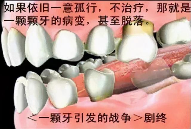 种植牙适用哪些群体？种植前需要做什么？看完一目了然