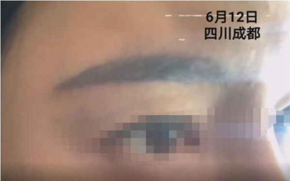 “转运眉”卧底调查：文个眉就能转运？女子被推销花18万文眉