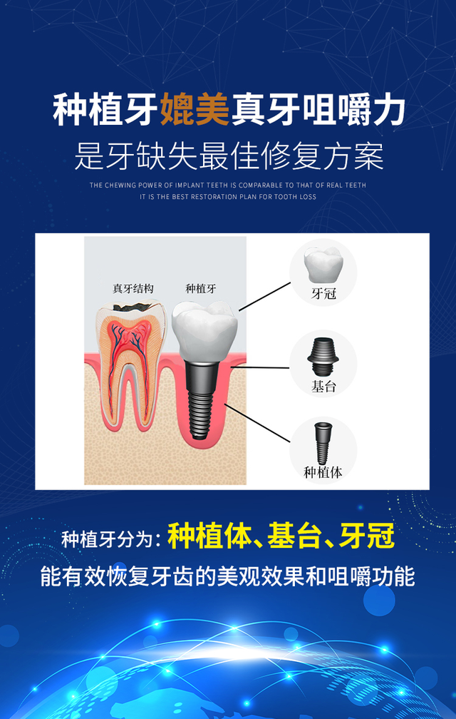 揭秘！大部分缺牙老人不知道的——种植牙全过程