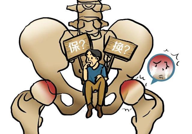 「视频」股骨头坏死：保髋or换髋？看这篇就够了