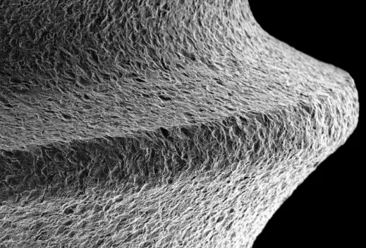 种植体的“SLA”是什么意思？种植体表面处理大揭秘