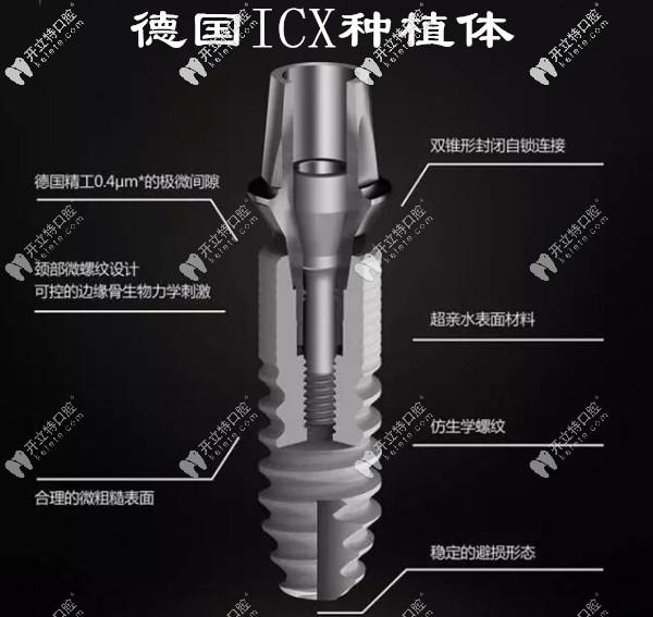 关于德国icx种植体长度和直径的规格你知多少？