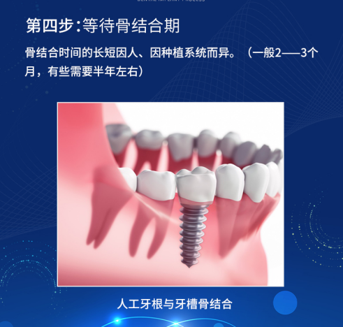 揭秘！大部分缺牙老人不知道的——种植牙全过程