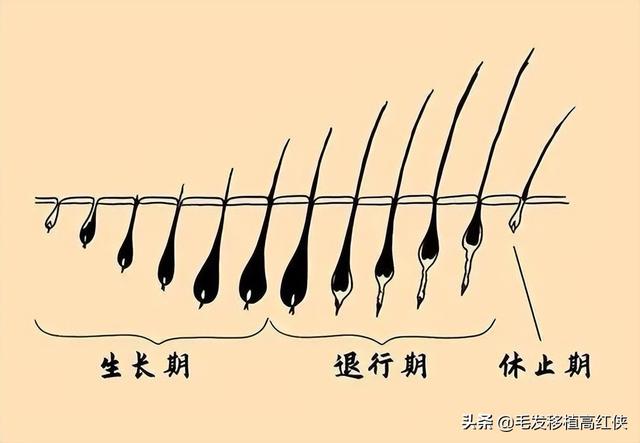 植眉是怎样的？一文说清楚大家关心的植眉问题