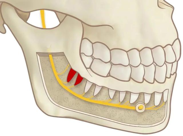 拔牙后的「危险」麻木感，要这样应对和处理#拔牙「并发症」
