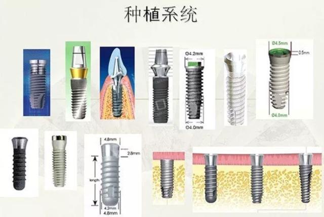 做种植牙，那么多牌子怎么选？但更关键的是选对这2项