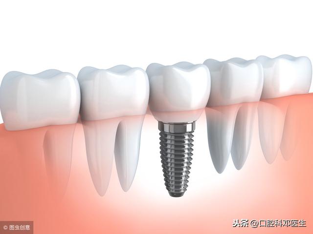 种植牙也有4大天敌，你是天敌吗？