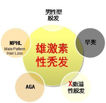 5个男人1个秃？快来了解雄激素性秃发的综合治疗