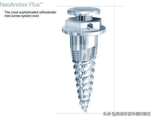 如果说拔牙是被砍一刀，那打支抗钉就相当于被扎一针