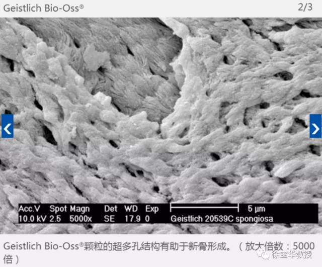 法令纹深、鼻基底凹陷？鼻基底骨增量手术详解