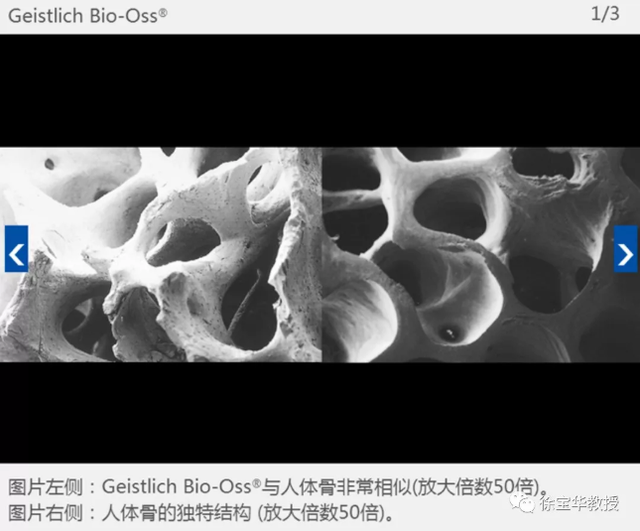 法令纹深、鼻基底凹陷？鼻基底骨增量手术详解