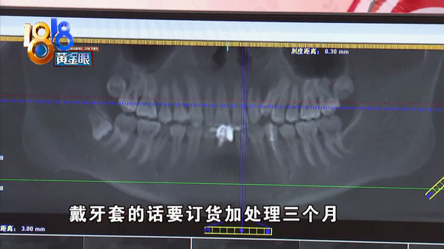 牙都拔了才知道，植骨可能会失败？