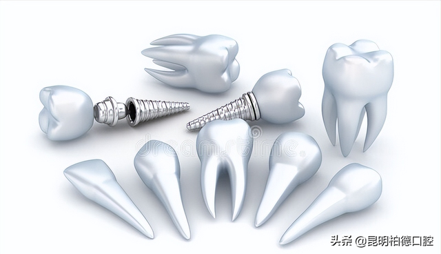 「牙齿那些事儿」No.167丨种植牙掉了还能再种吗？