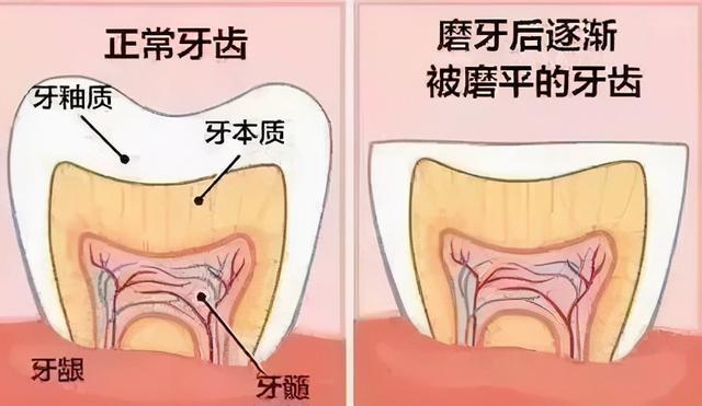 磨牙是因为肚子里有虫？四大病因看你中了哪个