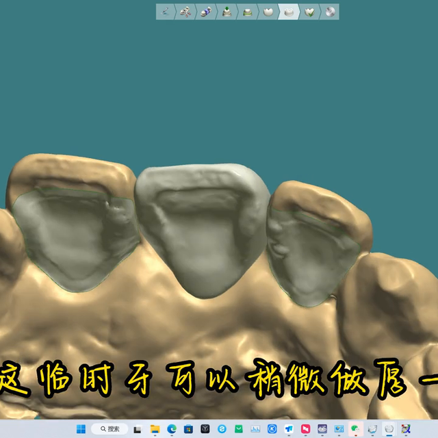 教你如何制作临时牙，简单易学