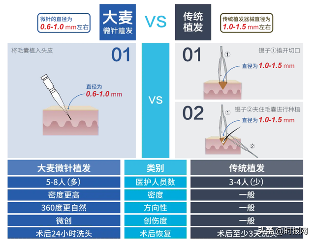 大麦植发，让头发悄然变美的“针”帮手