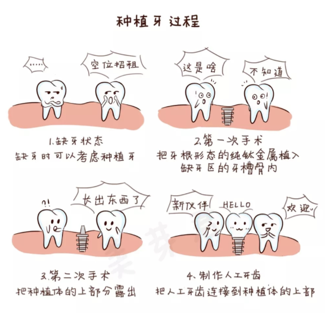 做种植牙时，直接把“螺丝”种进牙龈安全吗？会对人体有害吗？