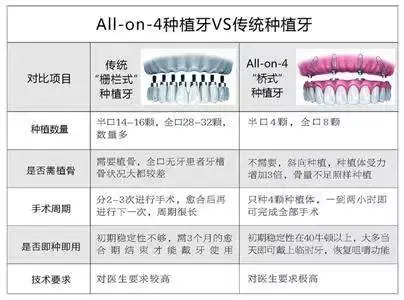 全口缺失牙，全口即刻修复种植牙技术