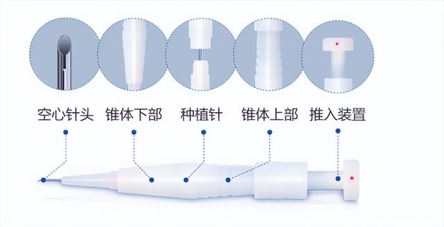 大麦微针不剃发植发 守护女性发友隐私