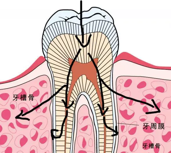 为什么我的牙齿状况种牙最好？烤瓷牙和种植牙这样选！