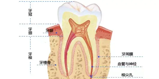 为什么我的牙齿状况种牙最好？烤瓷牙和种植牙这样选！