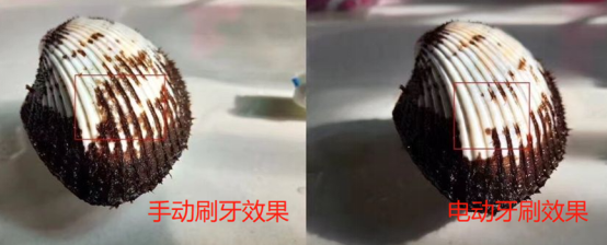 种植牙可以用电动牙刷吗？须知三大风险弊端！