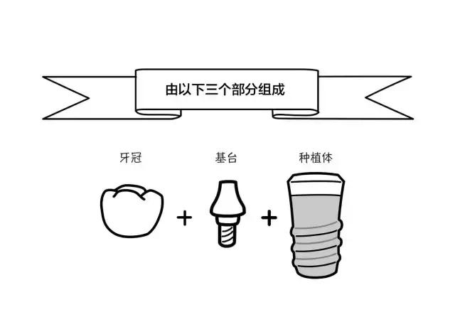 有人是说种植牙是在牙龈里面放一粒种子，生根发芽？