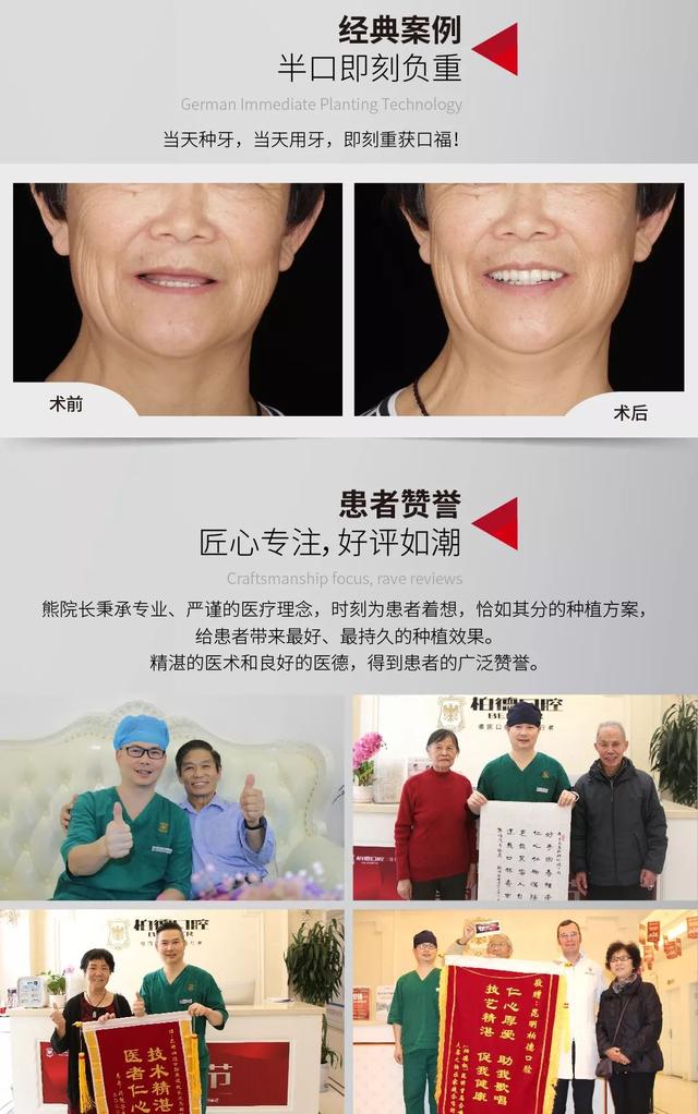 《新华名医谈》对话柏德口腔丨熊俊：如何选择适合自己的种植牙