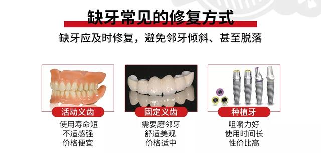 《新华名医谈》对话柏德口腔丨熊俊：如何选择适合自己的种植牙