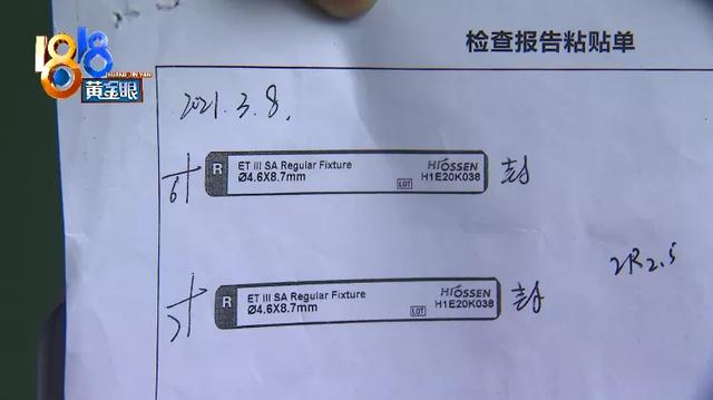 种植四颗牙齿“基台”进口还是国产