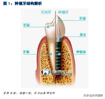 口腔医疗之种植牙行业专题报告：未来十年，十倍成长