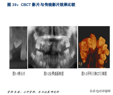 口腔医疗之种植牙行业专题报告：未来十年，十倍成长