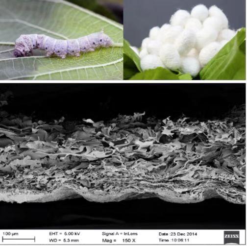 你的种植牙耗材竟可用蚕茧提取，全球首次！武汉专家历时14年取得成功