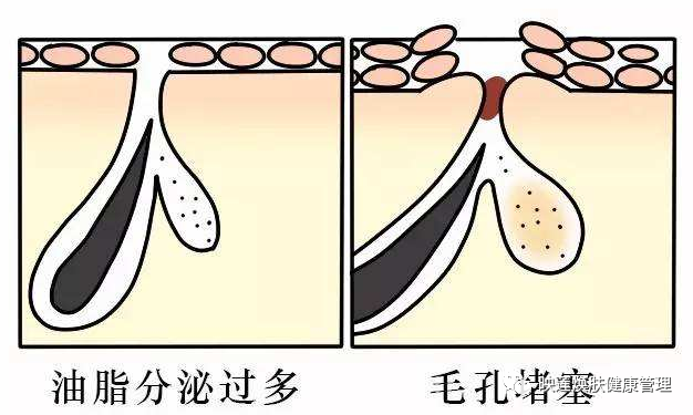 皮肤粗糙、满脸油光、皮肤缺水怎么办？来听听知名专家怎么说