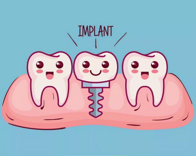 「牙齿那些事儿」No.29丨为什么牙医都推荐做种植牙？