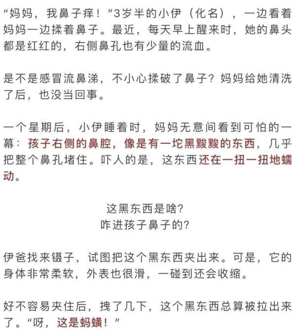 头皮发麻！3岁娃鼻子里竟有条蠕动的蚂蟥，足足4厘米长