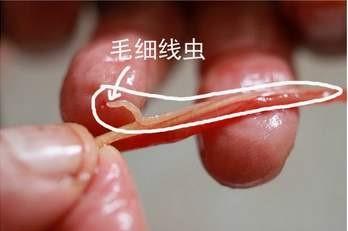 4种鱼类身上常见的“寄生虫”，3种无害，一种可寄生人体