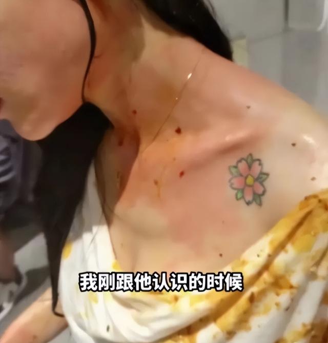 美女被丈夫家暴16次，肠子被打烂粪便污染腹腔，需终身挂粪袋